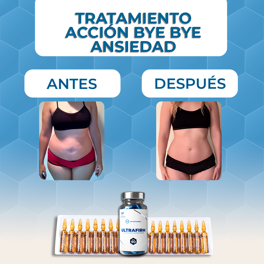 TRATAMIENTO ULTRA ACCIÓN: Bye Bye Ansiedad