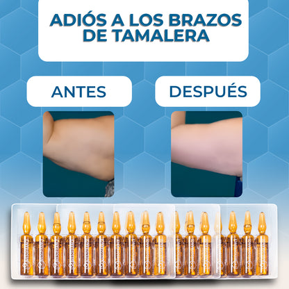 Tratamiento Adiós a los Brazos de Tamalera