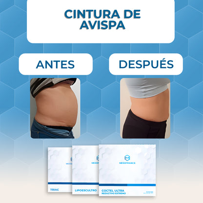 Tratamiento Cintura de Avispa