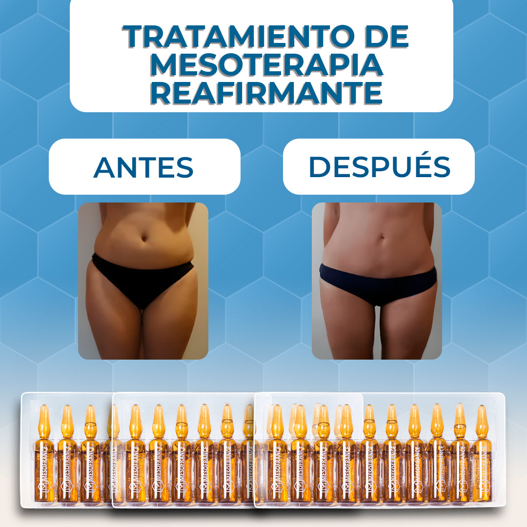 Tratamiento de Mesoterapia Reafirmante