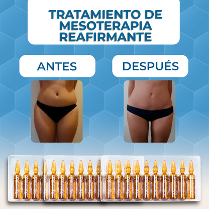 Tratamiento de Mesoterapia Reafirmante