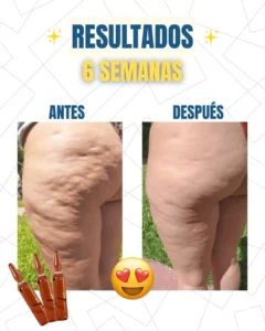Resultados reales 3
