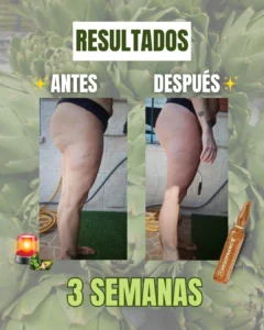 tratamiento drenante 4