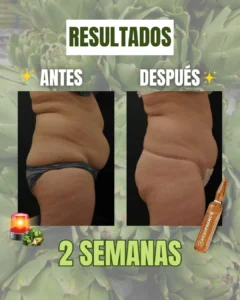 tratamiento drenante 5