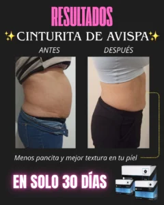Resultados 2