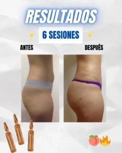 Resultados GLUTEOLIFT 4