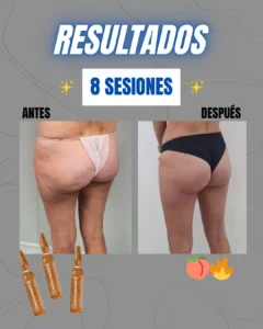 Resultados GLUTEOLIFT 3