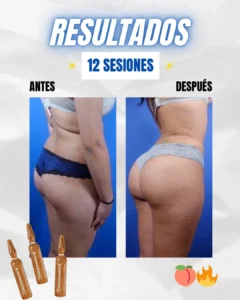 Resultados GLUTEOLIFT 2