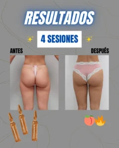 Resultados GLUTEOLIFT 1